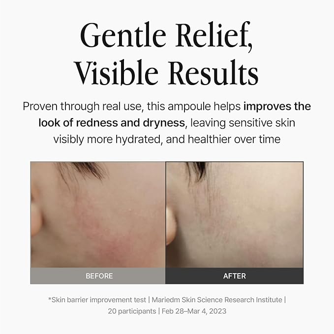 Ampoule 1.35 fl oz – Lightweight Hydrating Serum with Panthenol, Witch Hazel Water & Amino Acid Complex, pH 5.5 Moisture Balance for Sensitive Skin